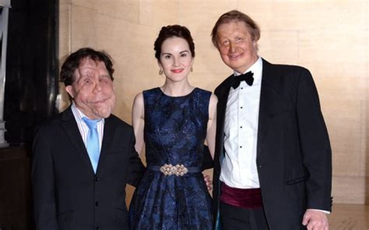 The Inspiring Story of Adam Pearson's Wife - A Journey of Love and Resilience