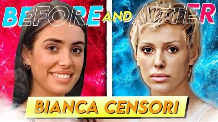 Bianca Censori Implant: A Comprehensive Guide to Her Journey and Achievements