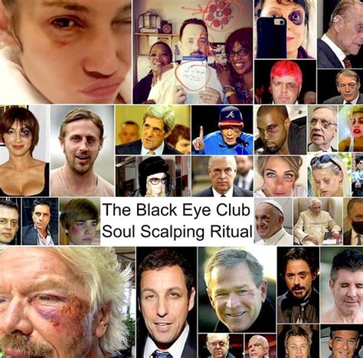 Unveiling the Black Eye Theory: A Comprehensive Exploration