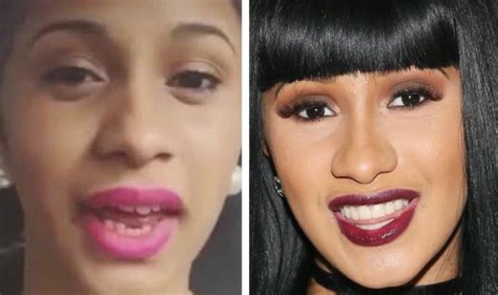 Cardi B Teeth: The Story Behind Her Iconic Smile