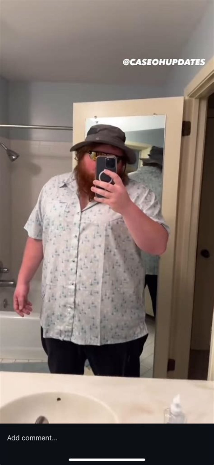 Caseoh Full Body: A Comprehensive Guide to Understanding and Enhancing Your Knowledge