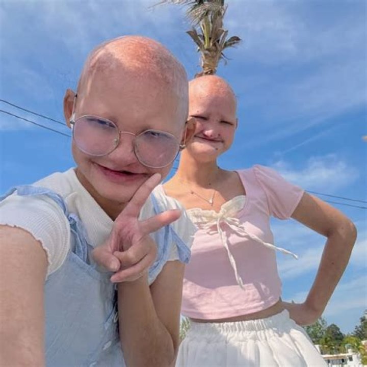 Chanok Twins: What Happened &ndash; A Comprehensive Exploration