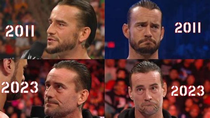 CM Punk Hair Transplant: The Ultimate Guide to Restoring Your Confidence