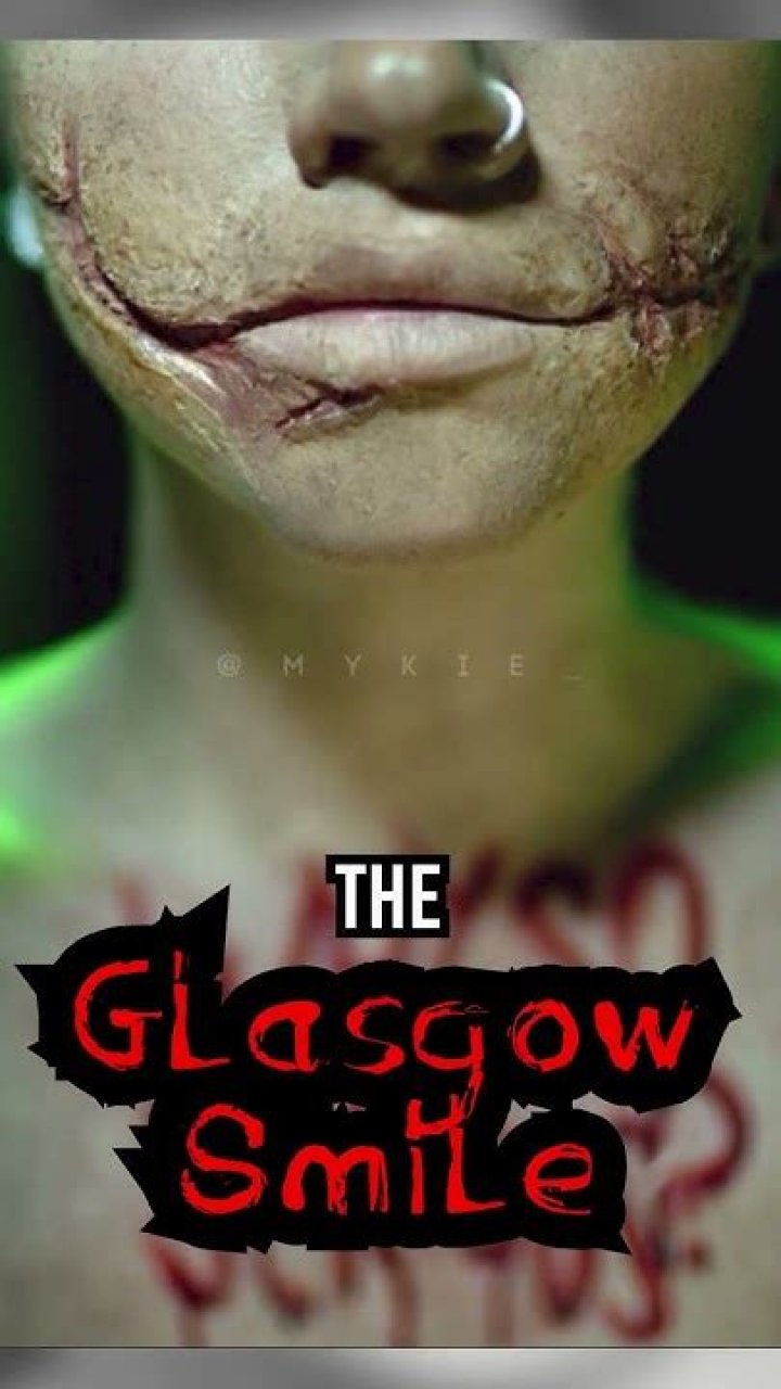 Glasgow Smile: A Revolutionary Approach to Oral Health and Confidence