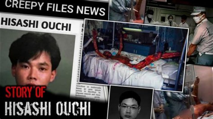 Hisashi Ouchi Death: Was It Real?