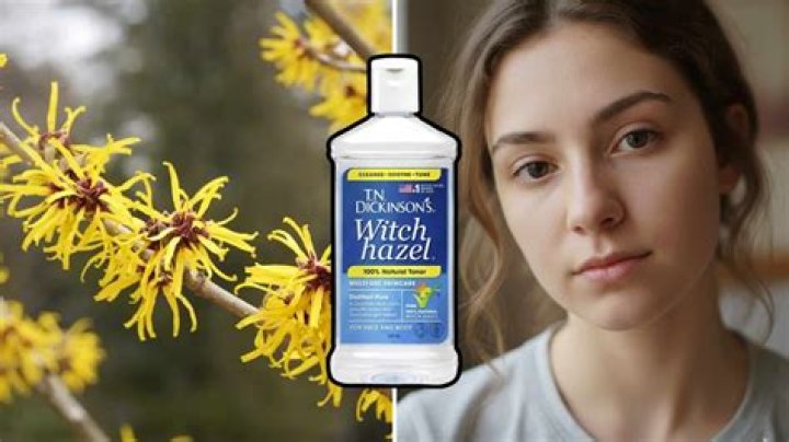 How Long Does Witch Hazel Last? Discover Its Shelf Life and Uses