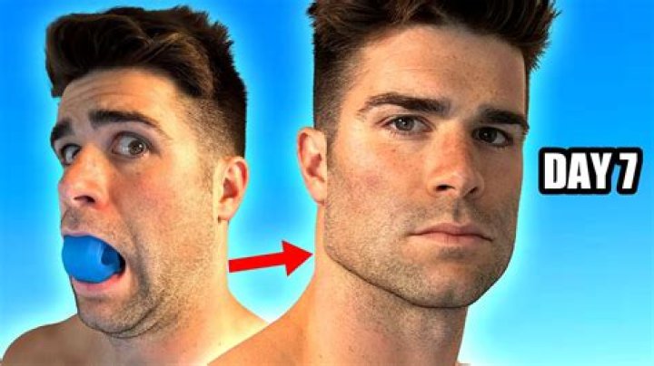 Jawline Exercises Before and After: Transform Your Face Shape with These Powerful Techniques