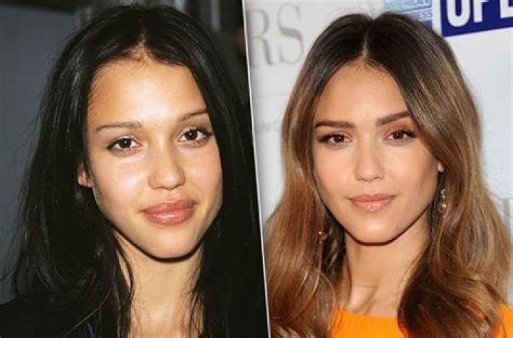 Jessica Alba Surgeries: Unveiling the Truth Behind Her Transformation