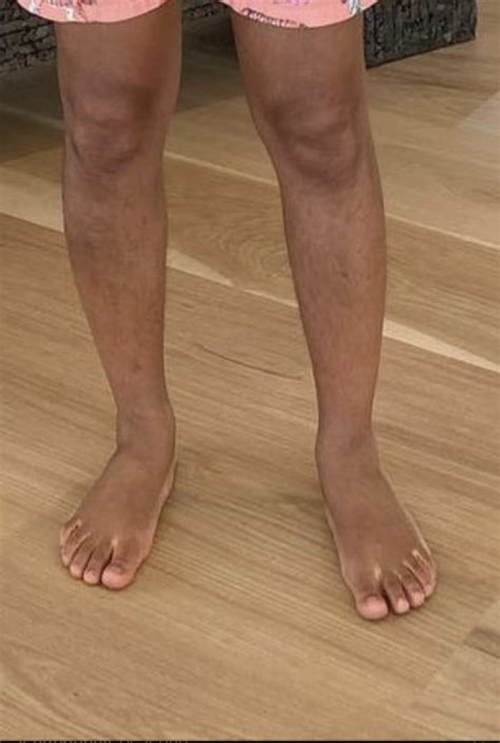 John Legend Feet: The Fascinating Story Behind the Iconic Singer&rsquo;s Unique Trait