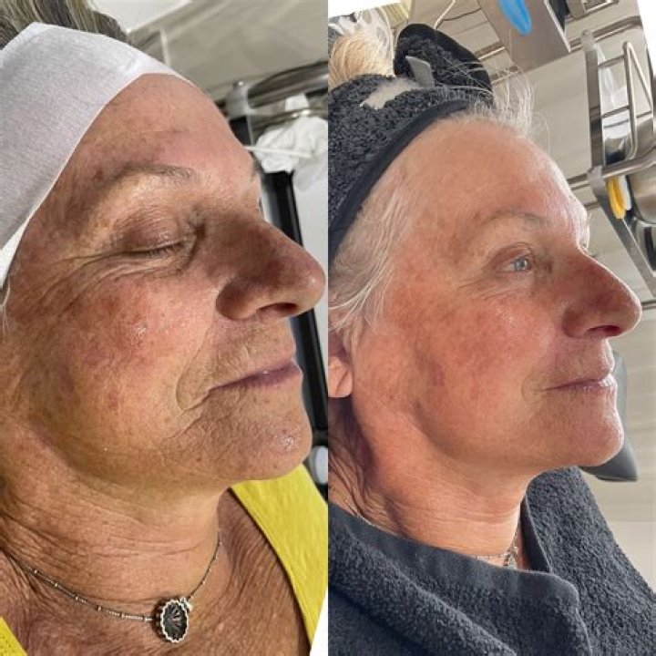 Kelly Rowland: A Journey Through Transformation Before and After