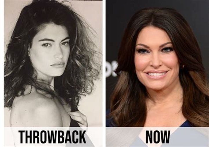 Kimberly Guilfoyle: A Before-and-After Transformation Journey