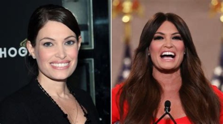 Kimberly Guilfoyle: Before and After Surgery - Transformation Revealed