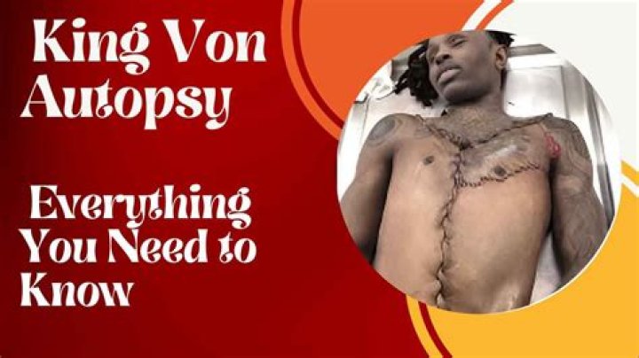Exploring the Controversy Surrounding King Von Autopsy Photos