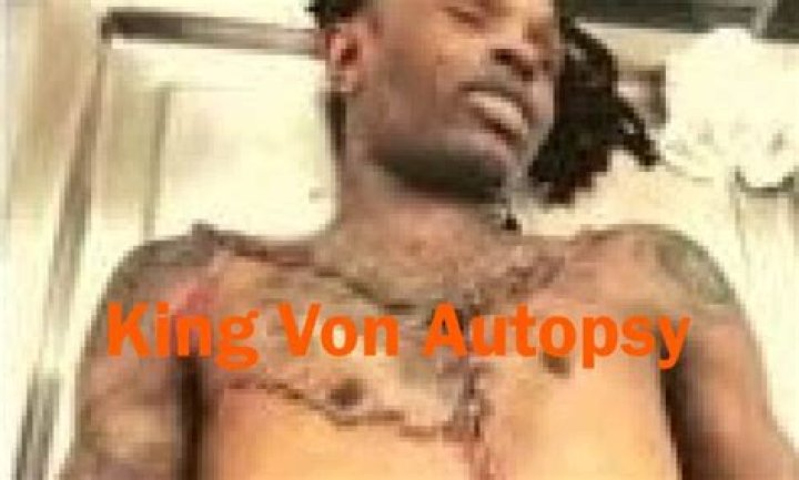 King Von Autopsy: Exclusive Details & Findings