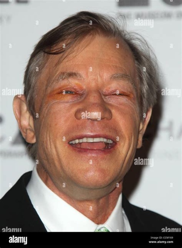Astonishing Insights: Michael York's Net Worth Unveiled