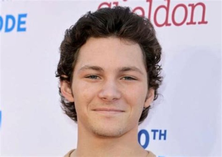 Montana Jordan Face Scar: Before & After Photos