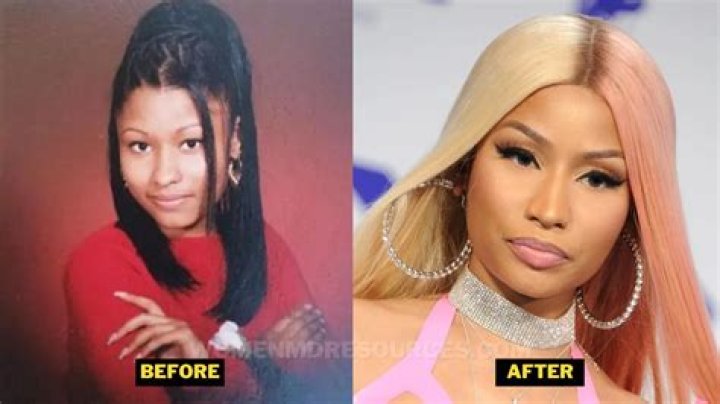 Nicki Before Plastic Surgery: Unveiling the Journey to Fame and Transformation