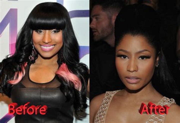 Nicki Minaj Before Any Surgery: A Journey Through Her Early Life and Transformation