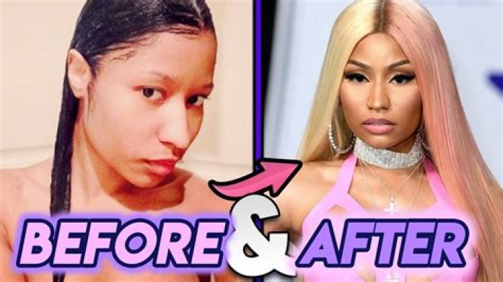 Nicki Minaj Before Plastic Surgery: The Journey of an Iconic Transformation