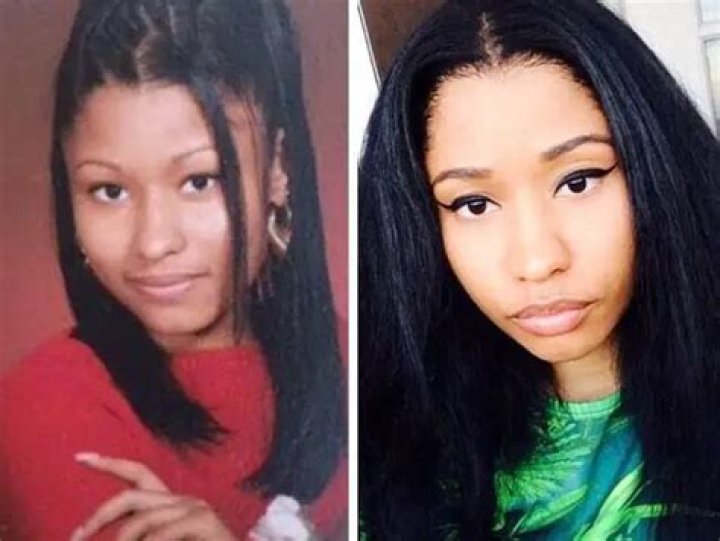 Nicki Minaj Before She Got Surgery: The Untold Story of Her Transformation