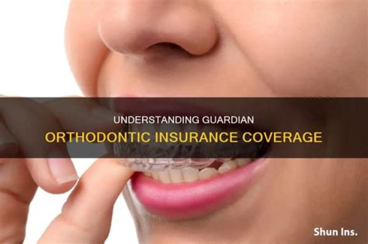 Unraveling Orthodontia Coverage: A Comprehensive Guide to Its Meaning