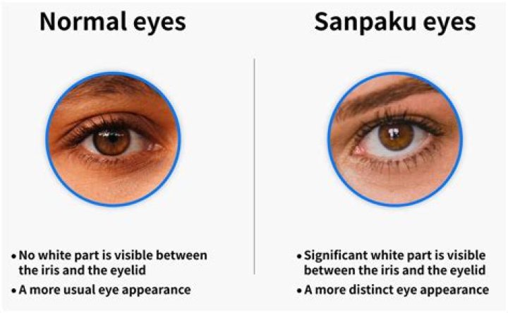 Unlocking the Mystery of Sanpaku Eyes: A Deep Dive into This Fascinating Feature