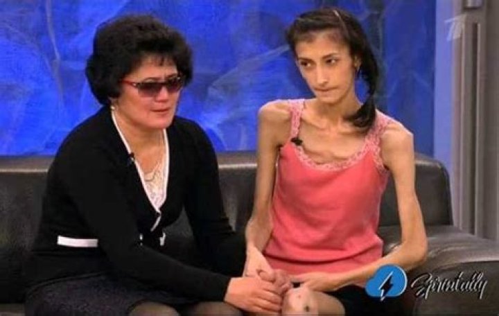 Who is the Skinniest Person in the World? Discover Their Incredible Journey