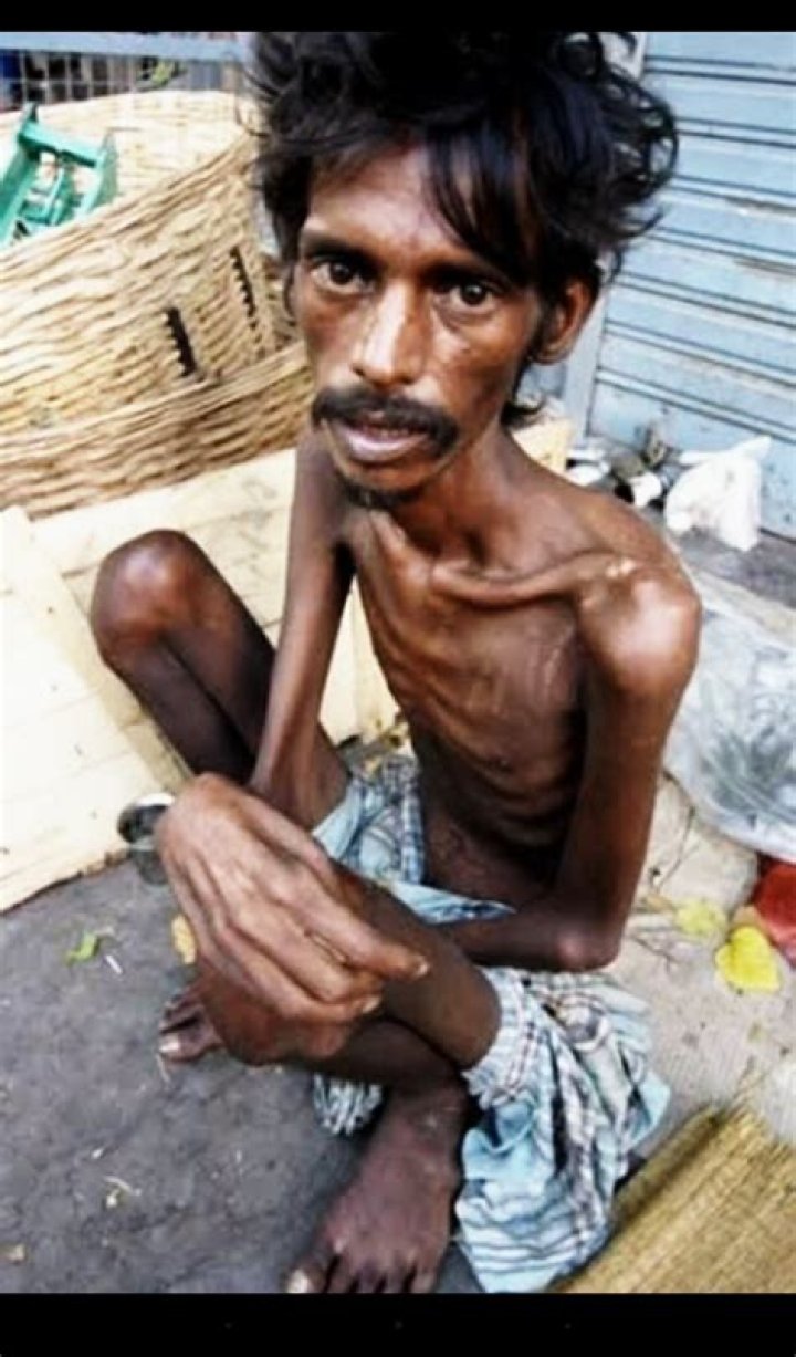 Discovering the Skinniest Person: A Journey Through Facts and Stories