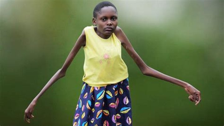 Discovering the Skinniest Girl in the World: A Journey into Uniqueness