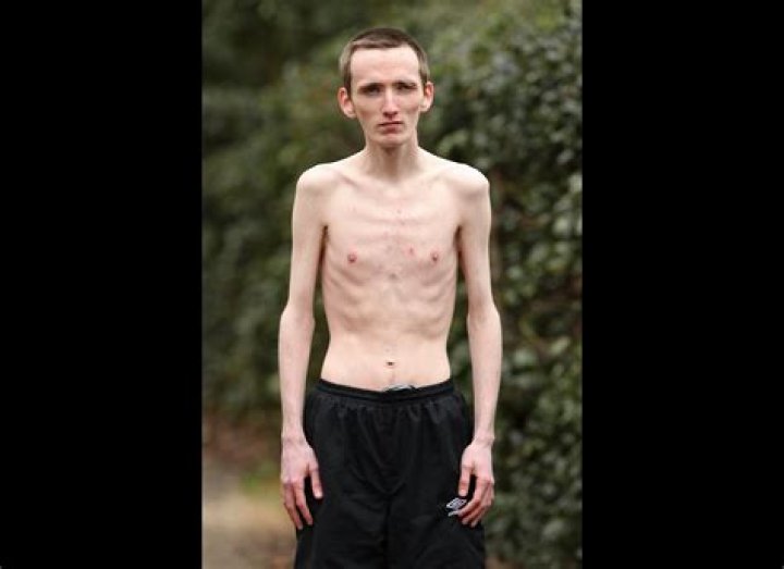 Discovering the Skinniest Guy in the World: An Unforgettable Journey