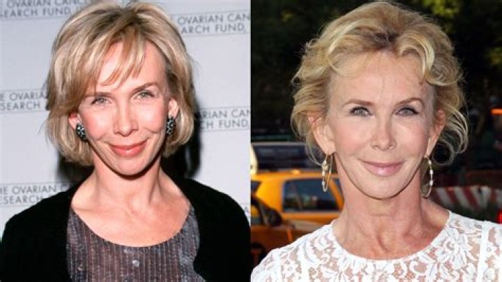 Trudie Styler: Before and After Plastic Surgery &ndash; A Comprehensive Exploration