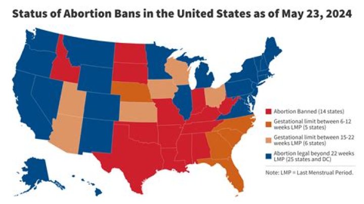 Understanding the Implications of the Abortion Ban in Texas