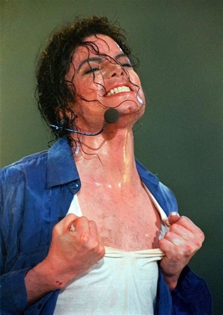 Vitiligo Michael Jackson Skin Condition: Understanding the Life and Legacy
