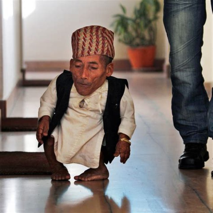 Exploring the Life of the World's Skinniest Person: A Comprehensive Look