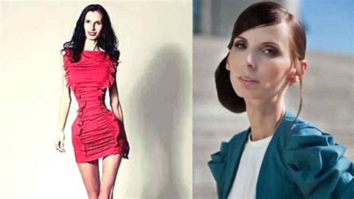 Exploring the Life of the World's Skinniest Person: A Journey Beyond Appearances