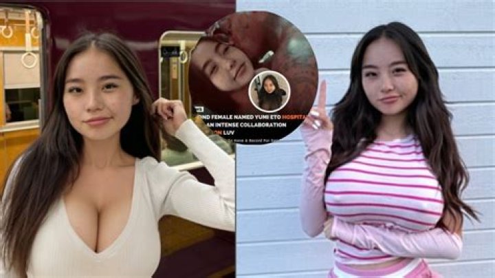 Yumi Eto Hospitalized: A Comprehensive Look Into the Recent Developations